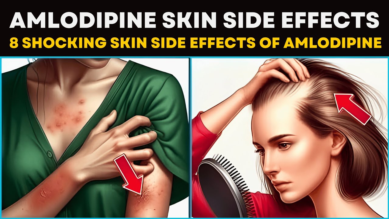 8 Hidden Amlodipine Side Effects on Your Skin — What to Watch For ...