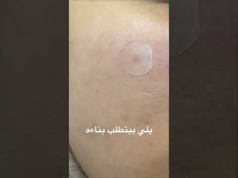 4 نصائح للعناية بالبشرة بعد جلسات الديرمابن  