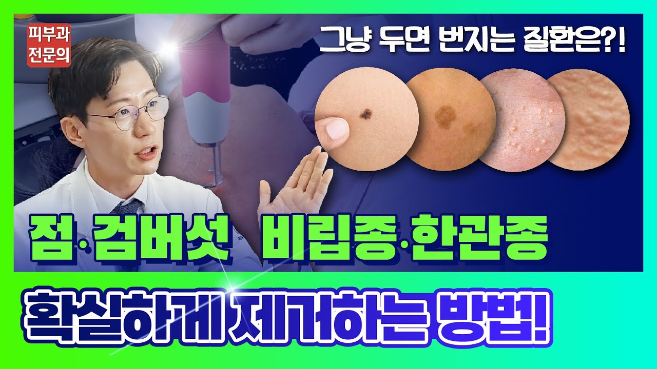 점/검버섯, 비립종/한관종 구분법! 치료 방법은? (feat.쥐젖,사마귀,좁쌀여드름)