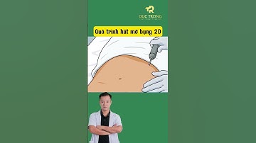Quá trình hút mỡ bụng 2D | Bác sĩ Trọng #shots #bacsitrong