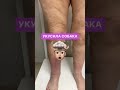 Пациентку укусила собака🐕🦺