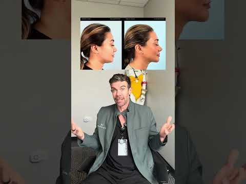 Video thumbnail: How I think about facial surgery — ManyFaces by Benjamin Caughlin, MD, FACS 