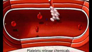 Blood clotting   Anatomy Video  MedlinePlus Medical Encyclopedia