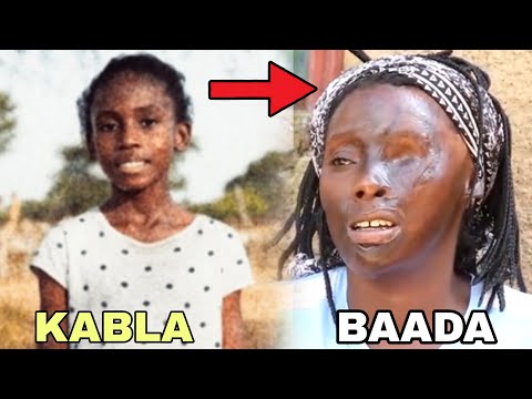 Nimekaa Hospitali Miaka 30 Na Nilikua Mrembo Sana Nitazame Nilivyo sasa