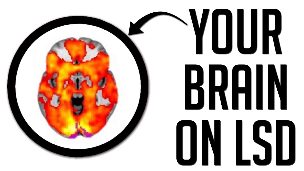 This Is Your Brain On Drugs Gif