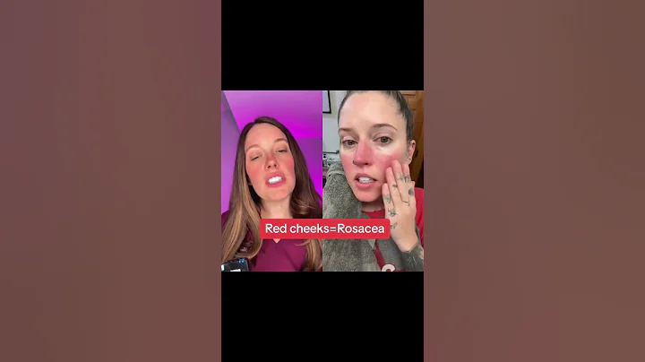 Avoid These Rosacea Triggers