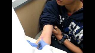 Me getting my blood test! @_myronspov