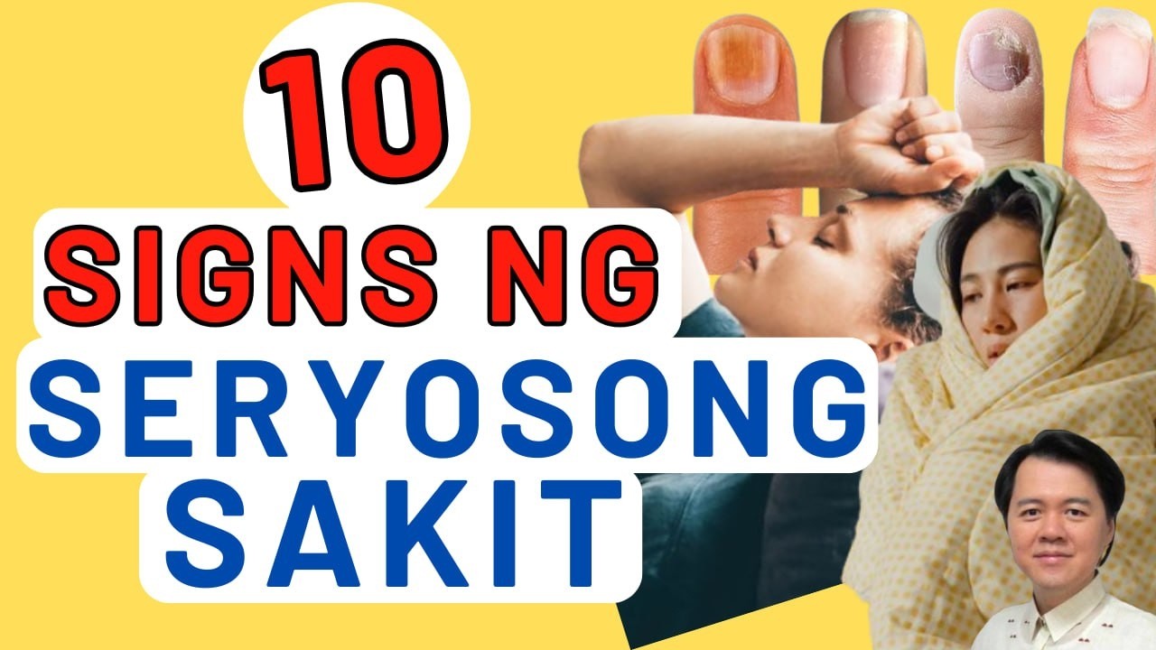 10 Signs ng Seryosong Sakit - Payo ni Doc Willie Ong