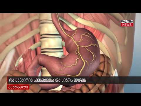 რა კავშირია სიმსუქნესა და კიბოს შორის