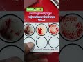 blood group test स्लाइड..? #laboratory #health #path #bloodgroup #newlifepath @Vikastomar228