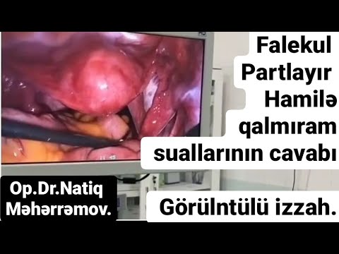 Video: VJ Lipa: hamilə və gözəldir