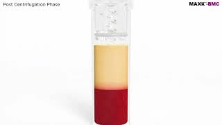 MAXX™ BMC: Maxx Bone Marrow Aspirate Concentration System