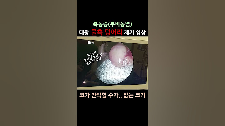 실제 축농중 수술영상ㅣ콧구멍 보다 큰 물혹이!? #shorts