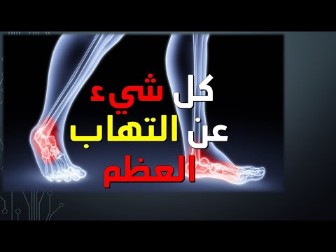 ما هي التهاب العظم و النقي | كيفية العلاج التهاب العظام