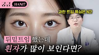 뒤밑트임 후 흰자 노출 쇼츠