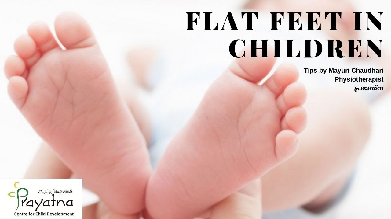 Flat Feet in Children Physiotherapy Prayatna YouTube