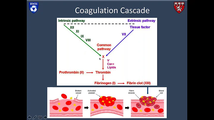 Anticoagulation for Venous Thromboembolism: Demystifying the Drugs