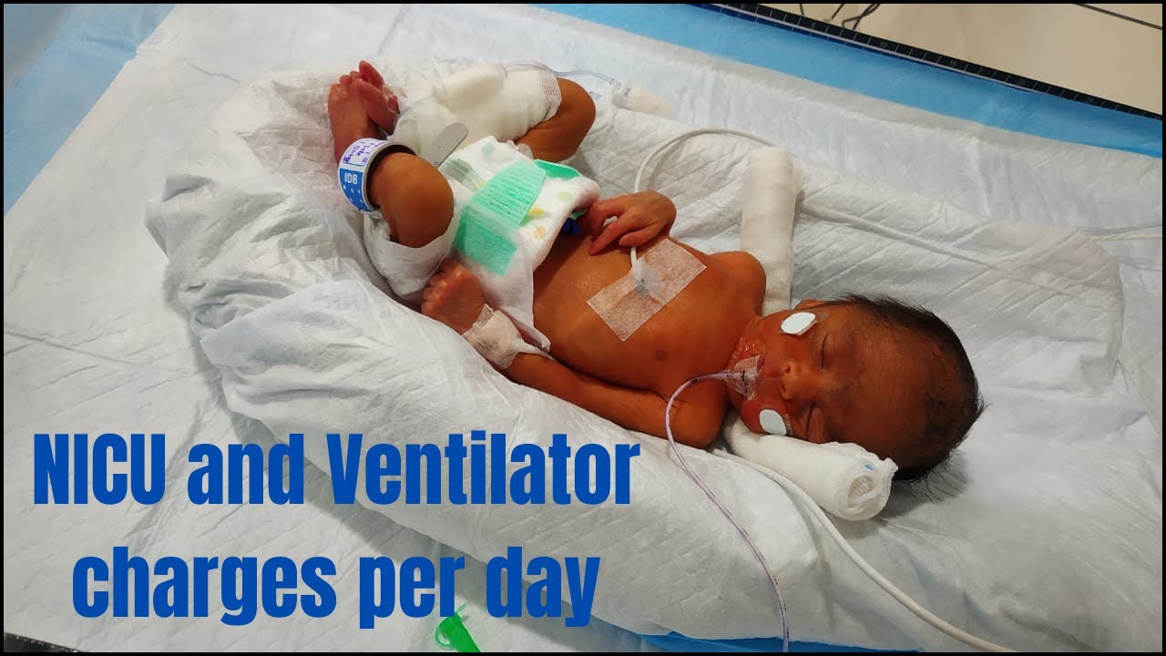 NICU And Ventilator Charges Per Day prematurebaby nicubaby nicu nicu-and-ventilator-charges-per-day-prematurebaby-nicubaby-nicu