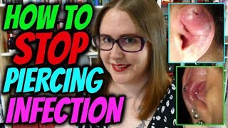 How To Prevent a Piercing Infection My 54 Piercings