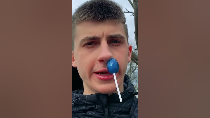LOLLIPOP STUCK IN NOSE! 😂 #shorts #funny #comedy #viral