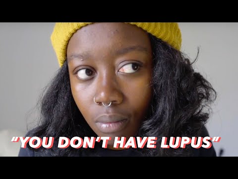 She Told Me I Didn&rsquo;t Have Lupus - Diagnosed With A Chronic Illness