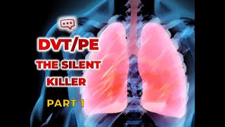 DVT & PE (Part 1)