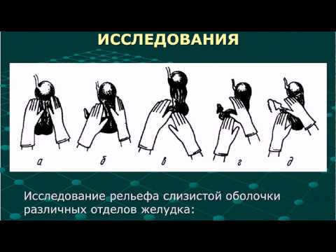 Рентген и анатомия желудка   лекция