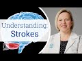 Stroke causes risk factors treatment and prevention  mass general brigham
