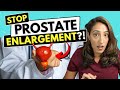 Best ways to prevent prostate enlargement explained by a urologist