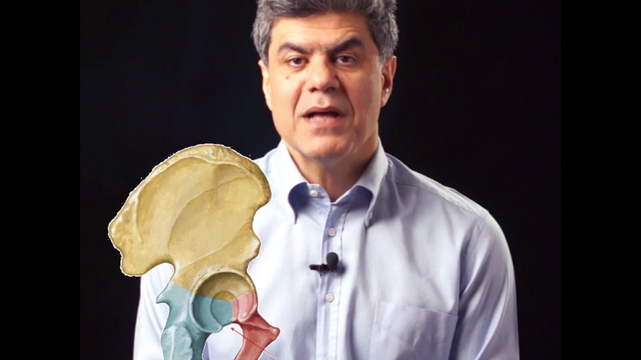 شکستگی کاسه لگن یا استابولوم چیست