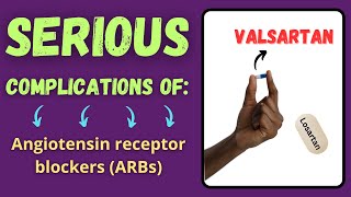 Serious Side Effects Of Losartan, Valsartan And Telmisartan Important Complications Of Arb