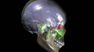 Human skull with brain endocast, paranasal sinuses, & mastoid sinuses