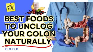 Top Foods to Naturally Clear Your Colon and Boost Digestion!