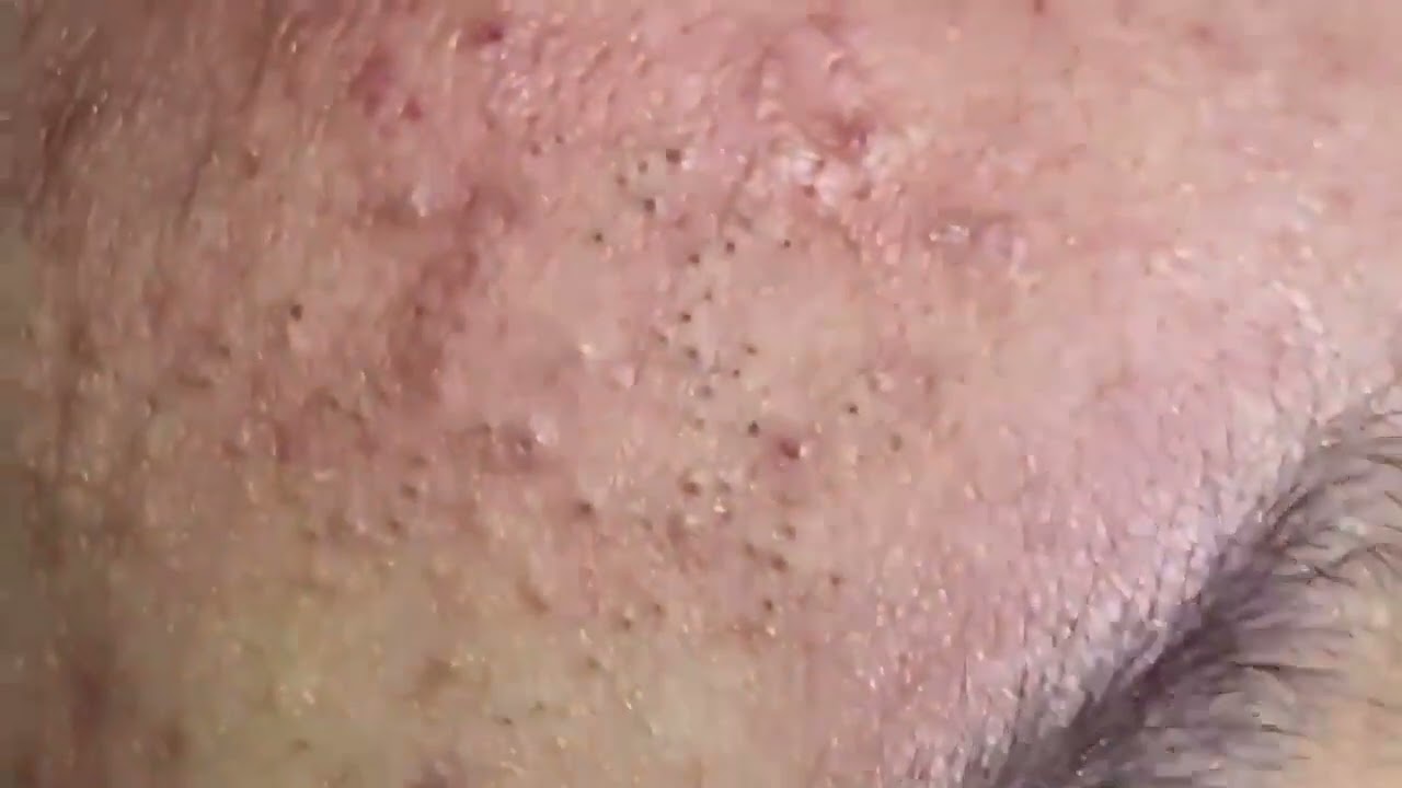 Relax Everyday Spa Ep28 YouTube