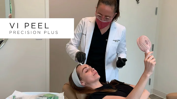 VI Peel Precision Plus Demo - Skin by Lovely