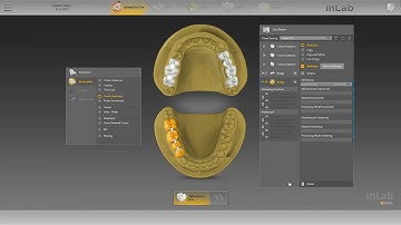FR-WEB-inlab-sw-18-0-administration-restauration-bridge.m4v