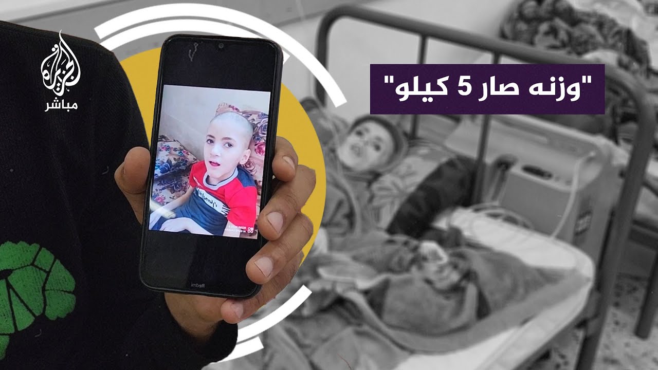 تدهور حالة طفل فلسطيني جراء نقص الغذاء والأكسجين