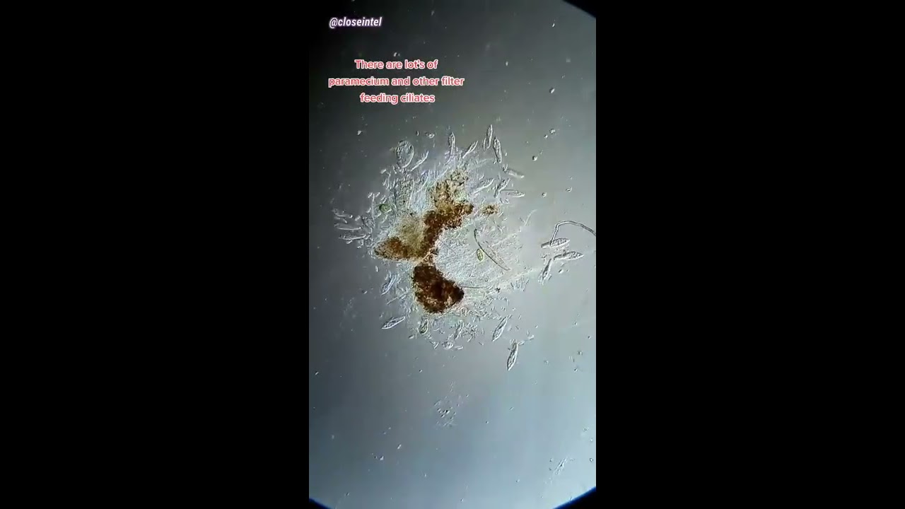 Rubbing Alcohol Vs Germs Under Microscope Science Microbiology