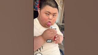 Strange Habits, Due to Rare Disease⁉️😳