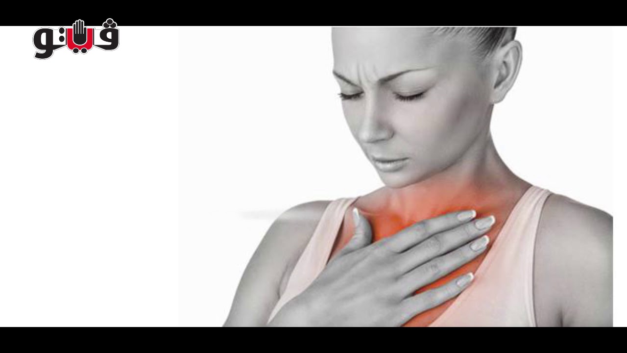 Изжога в пищеводе и желудке. Эзофагит рефлюкс кислотный. Жжение в груди при ГЭРБ. Эзофагит боль за грудиной.