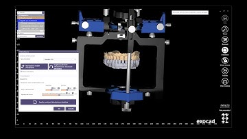 Exocad 10 minutes guide - Digital mounting on Panadent articulator ( Kois)