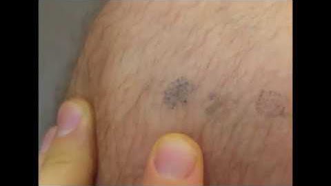 SMP gone bad? Beware of newcomers to SMP trying tattoo ink on your skin