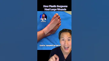 This Is How Plastic Surgeons Heal Large Wounds Shorts Skingraft 