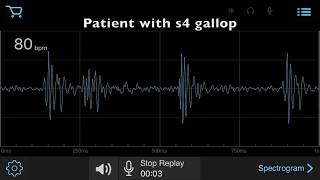 E-Stethescope & Auscultation App - s4 gallop screenshot 4