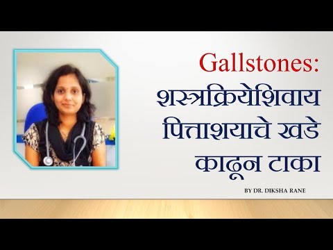 Gallstones: शस्त्रक्रियेशिवाय पित्ताशयाचे खडे काढून टाका