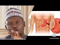 Maganin ciwon ulcer  dr abdulwahab abubakar goni bauchi hafizahullah