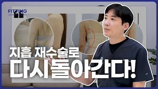 지방흡입을 한 번에 끝내야하는 이유! 지방흡입 재수술