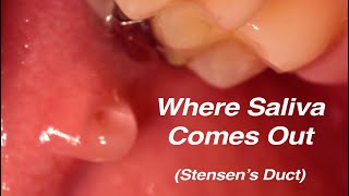 Stensen's Duct Salivation Superzoom - Where Saliva Comes From