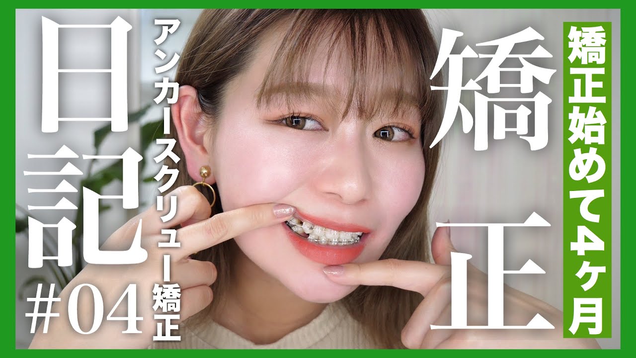 アンカー スクリュー スクリュー アンカー