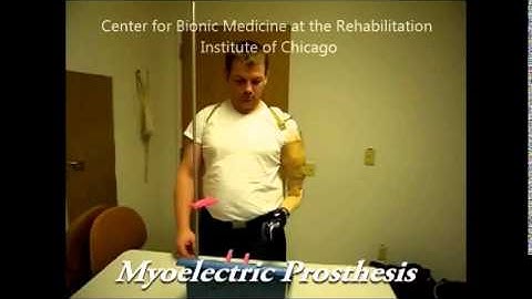 Different Types of Prostheses